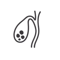 Gallbladder Stone