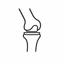 Knee Replacement Surgery