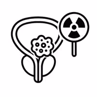 Prostate Cancer